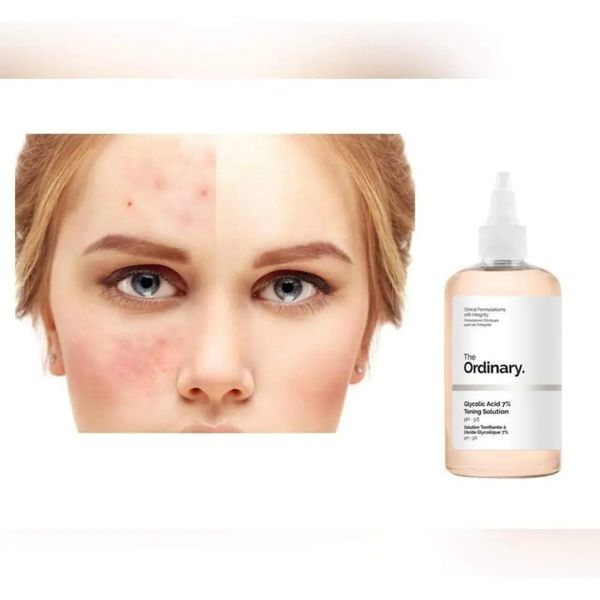 The Ordinary - Glycolic Acid 7% Toning Solution - Тонік із 7% гліколевою кислотою - 100ml фото